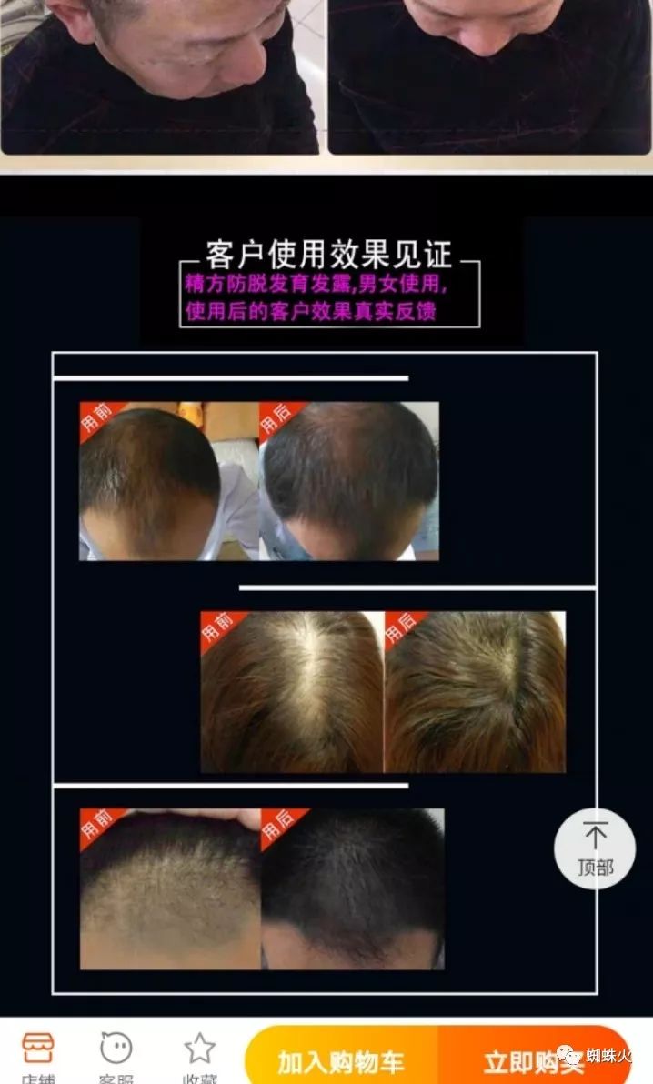 如何暴富：操作防脱发产品一本万利